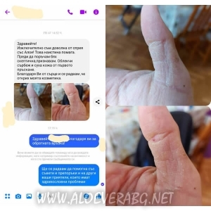 Спрей за спешна помощ с ферментирал гел Алое Вера, 400 мл - LR SOS Aloe Vera Emergency Spray